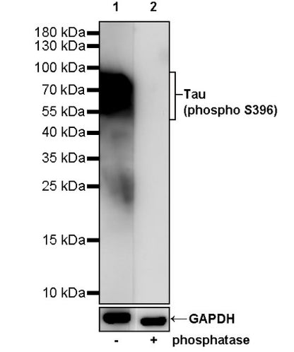 Tau (phospho S396) Recombinant Rabbit mAb (S-1016-38)
