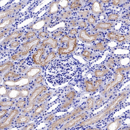 MYO7A Recombinant Rabbit mAb (S-2284-21)