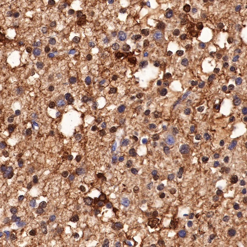 S-RMab® S100B Recombinant Rabbit mAb (SDT-518-45)