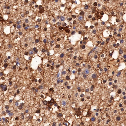 S-RMab® S100B Recombinant Rabbit mAb (SDT-518-45)