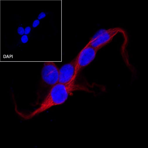 β-tubulin Recombinant Rabbit mAb (Alexa Fluor® 594 Conjugate) (S-312-113)