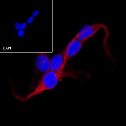 β-tubulin Recombinant Rabbit mAb (Alexa Fluor® 594 Conjugate) (S-312-113)