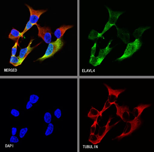 HuD/ELAVL4 Recombinant Rabbit mAb (S-1351-159)