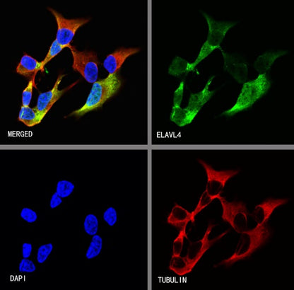 HuD/ELAVL4 Recombinant Rabbit mAb (S-1351-159)