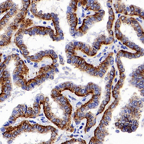 LAMP1 Recombinant Rabbit mAb (S-952-18)