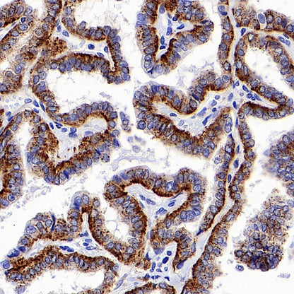 LAMP1 Recombinant Rabbit mAb (S-952-18)