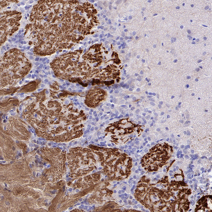 Olfactory Marker/OMP Recombinant Rabbit mAb (S-3513-32)