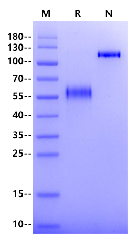 Osteoprotegerin/TNFRSF11B His Tag Protein, Human