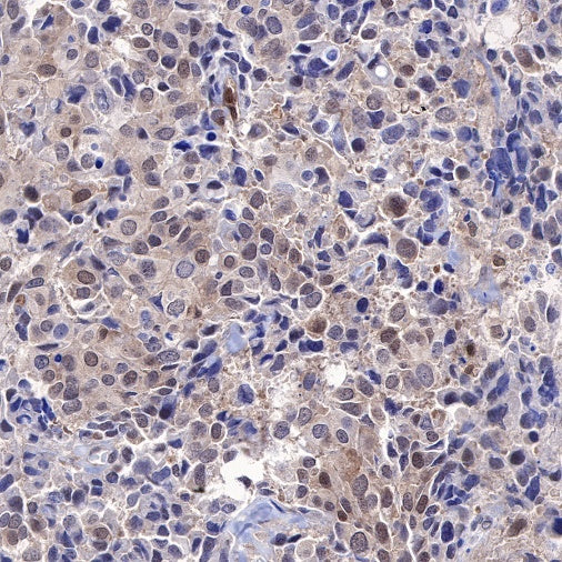 MEK3 Recombinant Rabbit mAb (S-835-23)