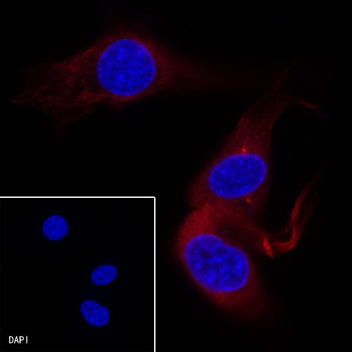 β-tubulin Recombinant Rabbit mAb (Alexa Fluor® 594 Conjugate) (S-312-113)