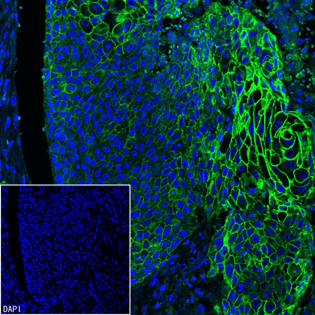 Desmoglein 3 Recombinant Rabbit mAb (SDT-3213-33)