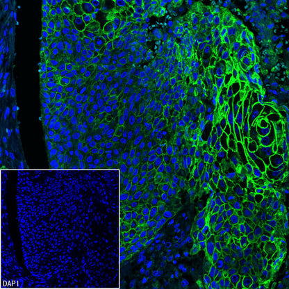 Desmoglein 3 Recombinant Rabbit mAb (SDT-3213-33)