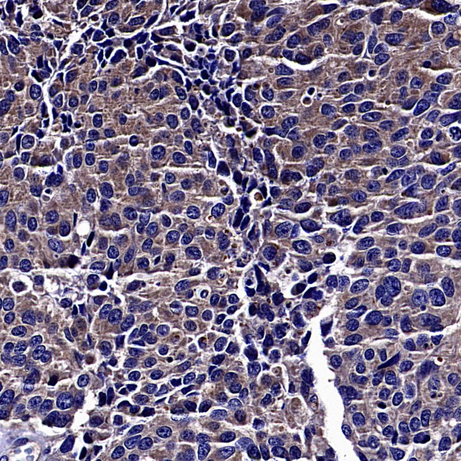 Rab27A Recombinant Rabbit mAb (S-4453-62)