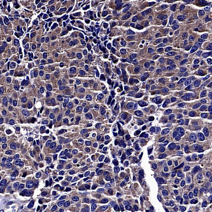 Rab27A Recombinant Rabbit mAb (S-4453-62)