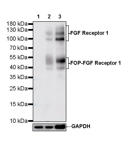 FGF Receptor 1 Recombinant Rabbit mAb (S-5668)
