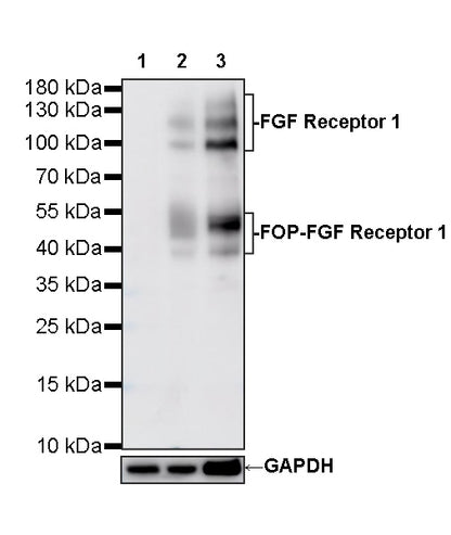 FGF Receptor 1 Recombinant Rabbit mAb (S-5668)