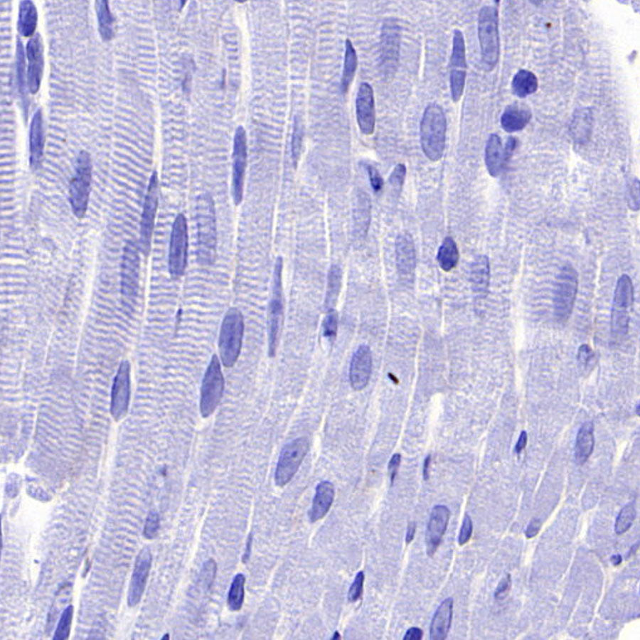 PTK7 Recombinant Rabbit mAb (SDT-2432-156)
