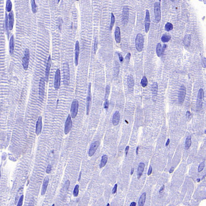 PTK7 Recombinant Rabbit mAb (SDT-2432-156)