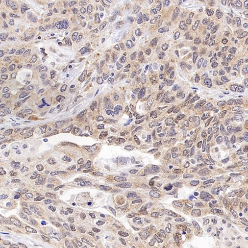 Bmi1 Recombinant Rabbit mAb (S-3313-71)