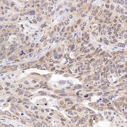 Bmi1 Recombinant Rabbit mAb (S-3313-71)