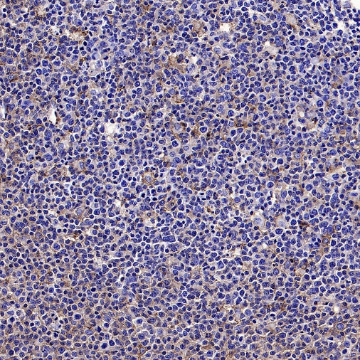 CMTM6 Recombinant Rabbit mAb (S-2013-4)