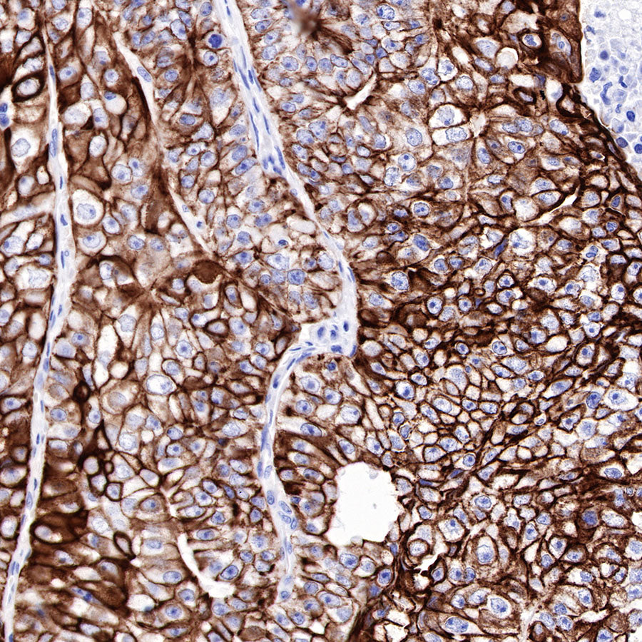 CK-LMW Recombinant Rabbit mAb (SDT-P003)