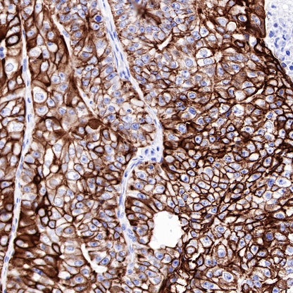 CK-LMW Recombinant Rabbit mAb (SDT-P003)