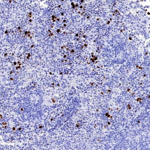 JNK1 + JNK2 + JNK3 (phospho T183+T183+T221) Recombinant Rabbit mAb (S-3593)