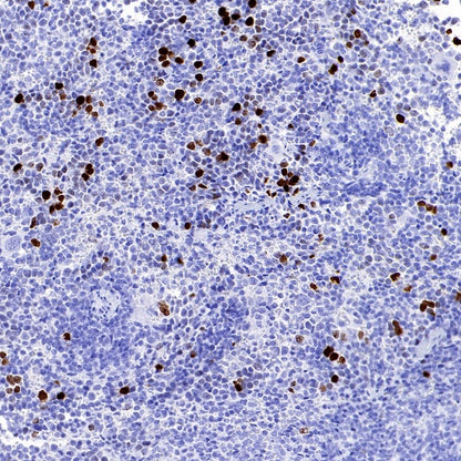 JNK1 + JNK2 + JNK3 (phospho T183+T183+T221) Recombinant Rabbit mAb (S-3593)