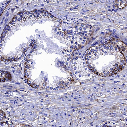 B7-H3 Recombinant Rabbit mAb (SDT-1333-8)