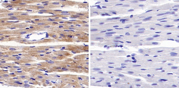 Phospho-PDHA1 (S293) Recombinant Rabbit mAb (S-1729-25)