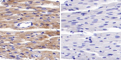 Phospho-PDHA1 (S293) Recombinant Rabbit mAb (S-1729-25)