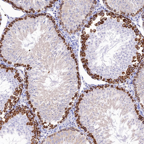 DAZL Rabbit Polyclonal Antibody