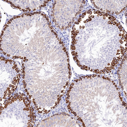 DAZL Rabbit Polyclonal Antibody