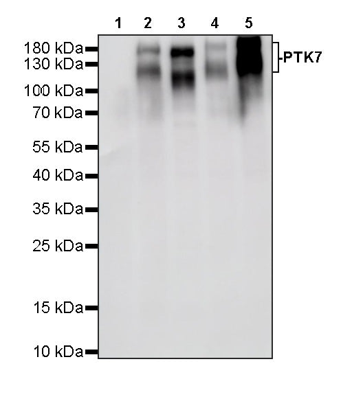 PTK7 Recombinant Rabbit mAb ,PBS Only(SDT-2432-136)