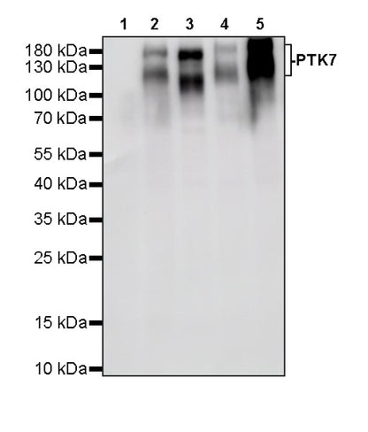 PTK7 Recombinant Rabbit mAb ,PBS Only(SDT-2432-136)
