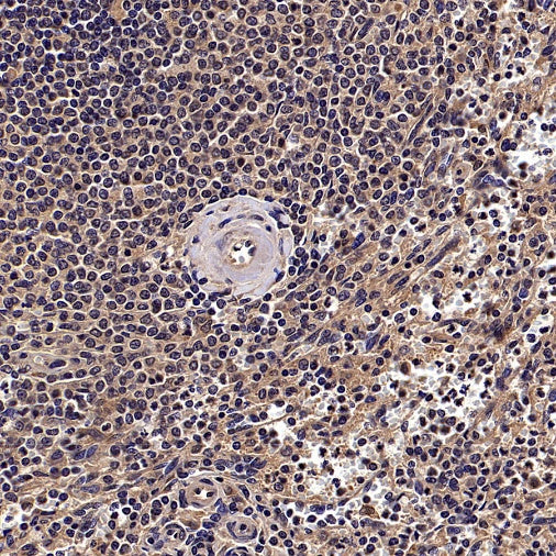 cIAP2 Recombinant Rabbit mAb (S-2483-8)