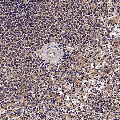 cIAP2 Recombinant Rabbit mAb (S-2483-8)