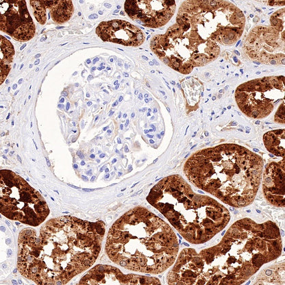 RBP4 Recombinant Rabbit mAb (S-693-111)