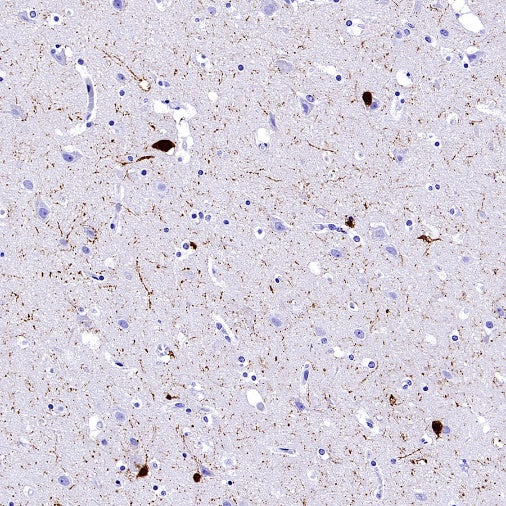 Calretinin Recombinant Rabbit mAb (SDT-2773-21)
