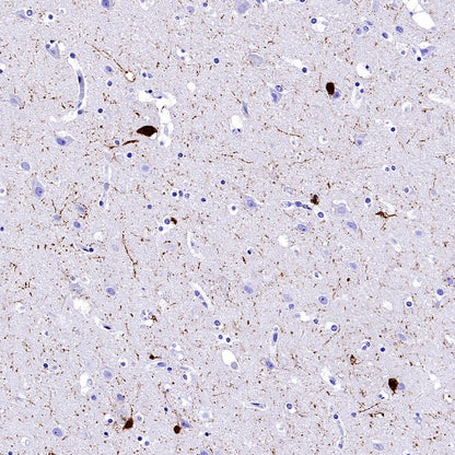 Calretinin Recombinant Rabbit mAb (SDT-2773-21)