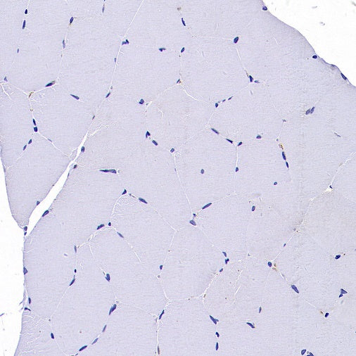 CaMKII alpha Recombinant Rabbit mAb (S-2451-54)