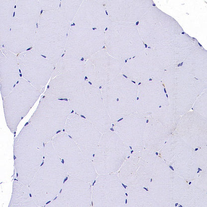 CaMKII alpha Recombinant Rabbit mAb (S-2451-54)