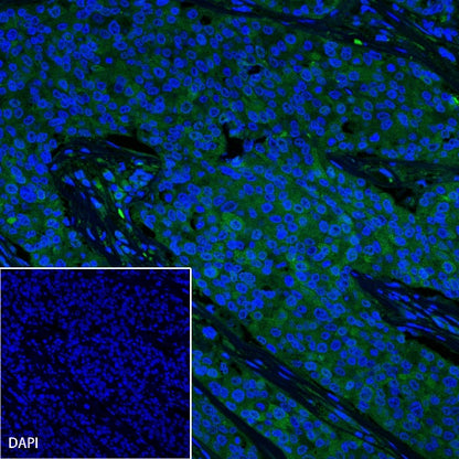 L-Lactate Dehydrogenase A/LDHA Rabbit Polyclonal Antibody