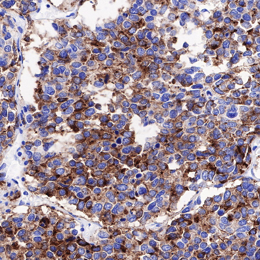 S-RMab® Chromogranin A Recombinant Rabbit mAb (SDT-074-57)