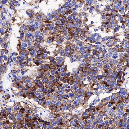 S-RMab® Chromogranin A Recombinant Rabbit mAb (SDT-074-57)