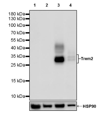 Trem2 Recombinant Rabbit mAb (S-2471-34)