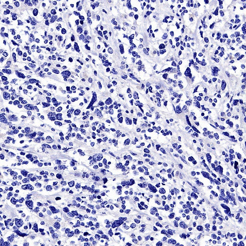 Myogenin Recombinant Rabbit mAb (SDT-3351)