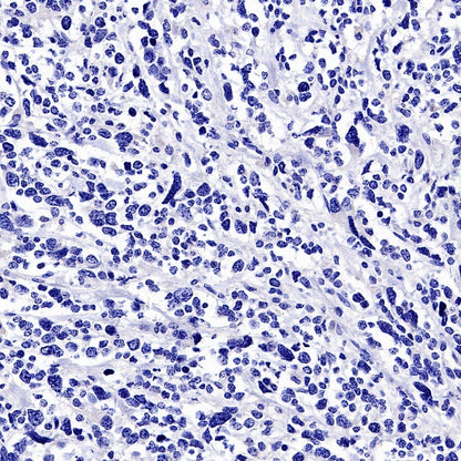 Myogenin Recombinant Rabbit mAb (SDT-3351)