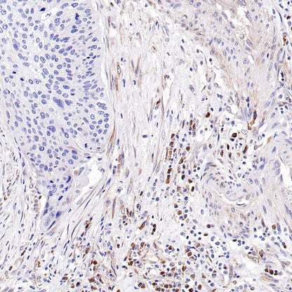 LC3B Recombinant Rabbit mAb (S-1599-142)